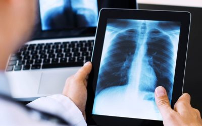 Radiologia digital e convencional: Vantagens, desvantagens e diferenças