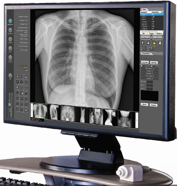 radiologia digital monitor